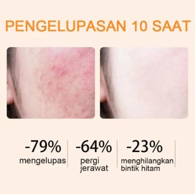 Final 3 Hours: 60%OFF🔥Orange Enzyme Exfoliating Gel