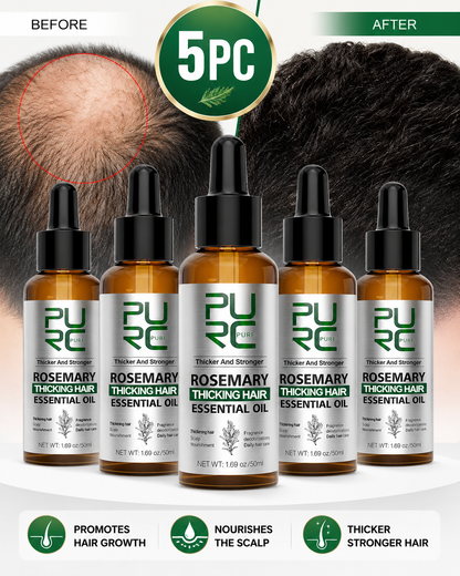 🌱 Organic Rosemary Hair Growth Oil