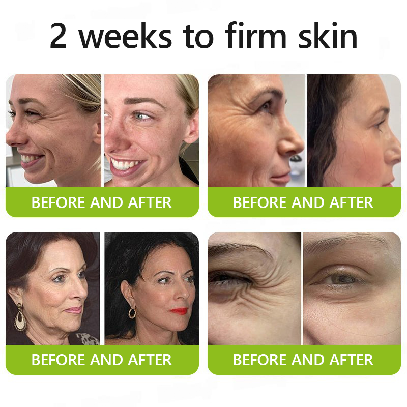 𝑶𝒇𝒇𝒊𝒄𝒊𝒂𝒍 𝑺𝒕𝒐𝒓𝒆👍| Regain youthful skin nown 💫LOVILDS® BOTOX & VITA A RETINOL SHOT Wrinkle Lift Tightening Cream