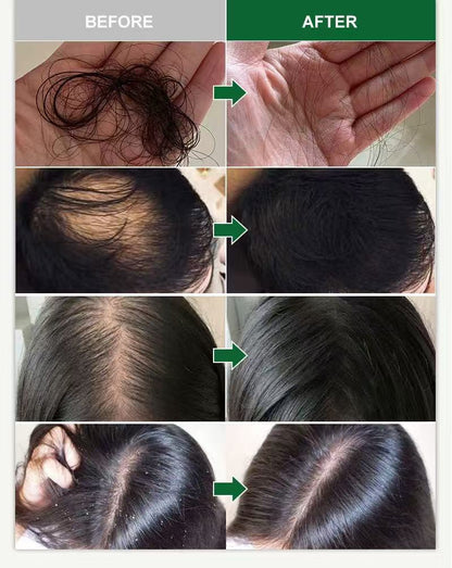 🌱 Organic Rosemary Hair Growth Oil