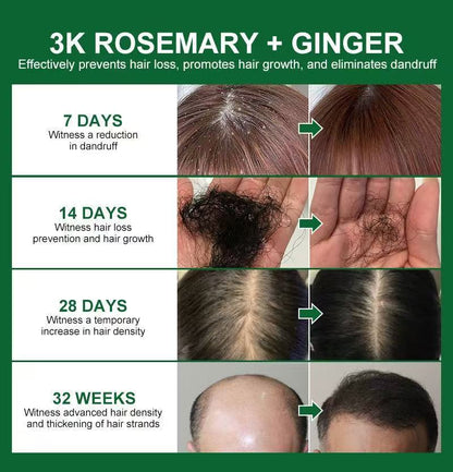 🌱 Organic Rosemary Hair Growth Oil