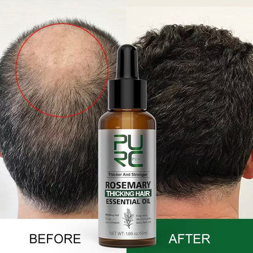 🌱 Organic Rosemary Hair Growth Oil